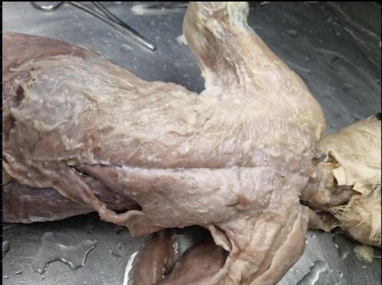肌肉纤维识别数据集-数据中国